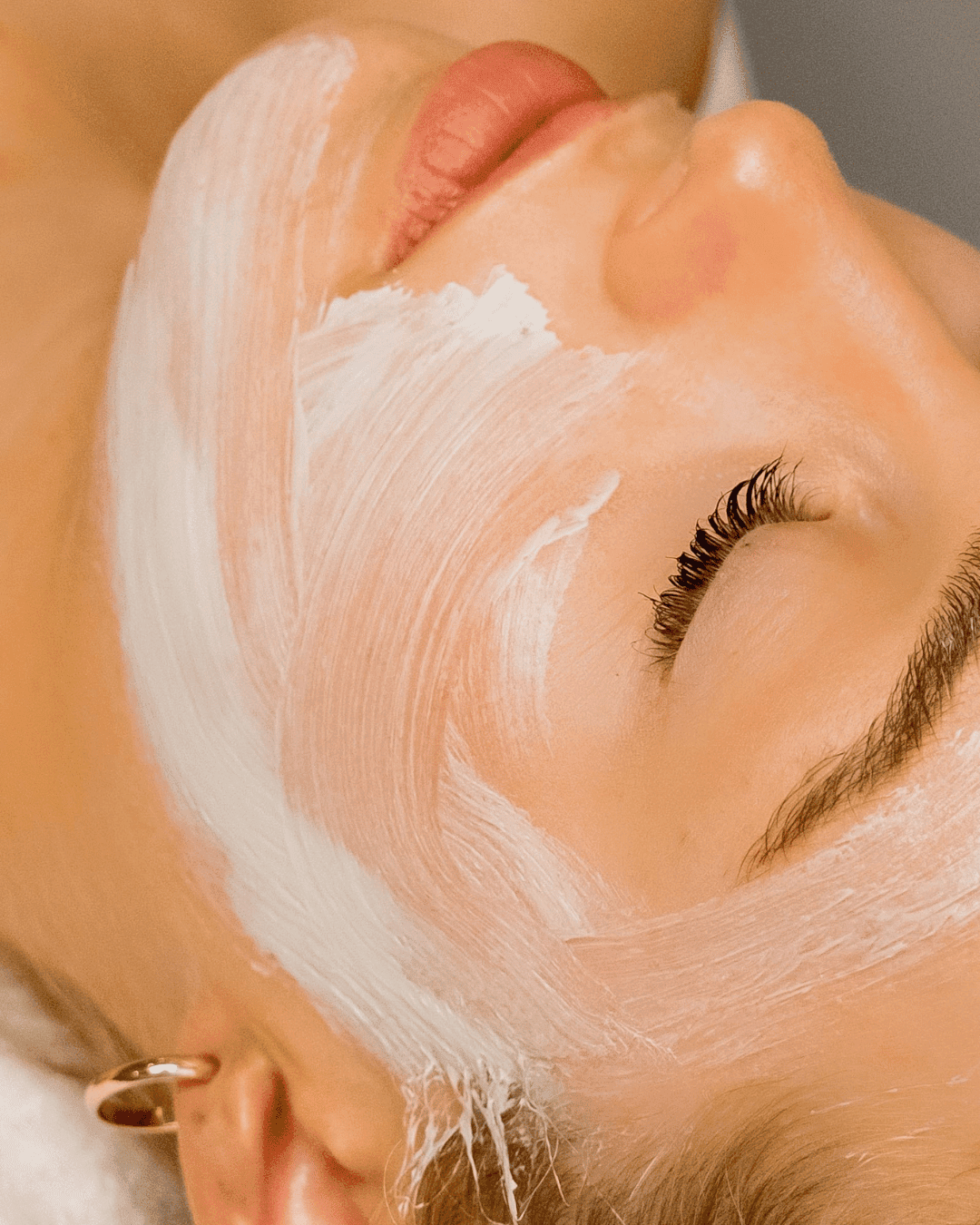 Refinement & Resurfacing