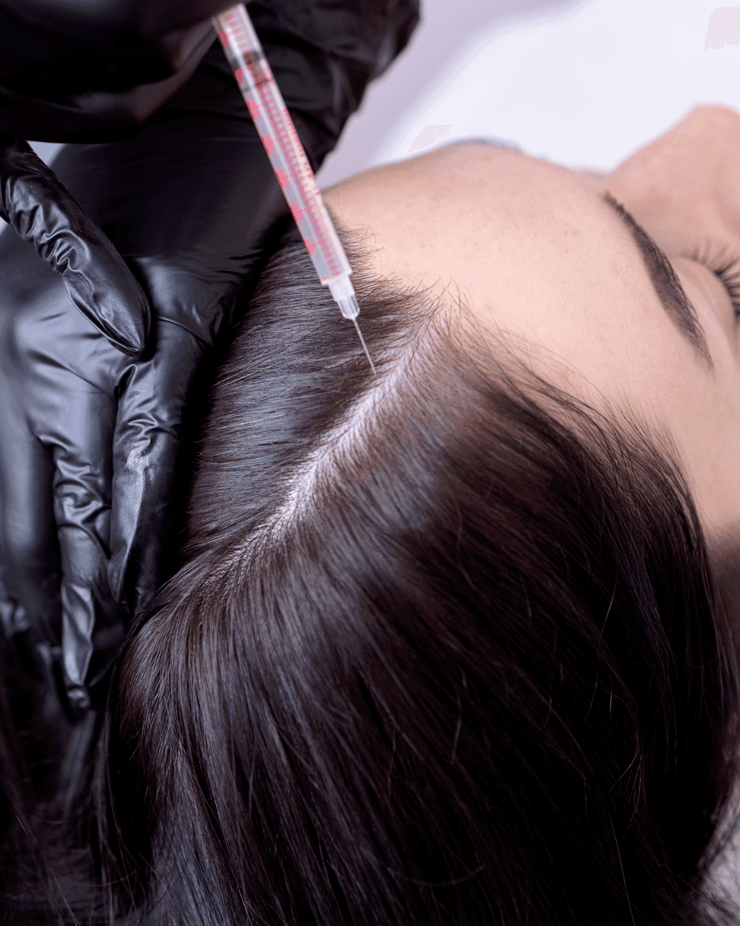 PRP (Face & Hair)