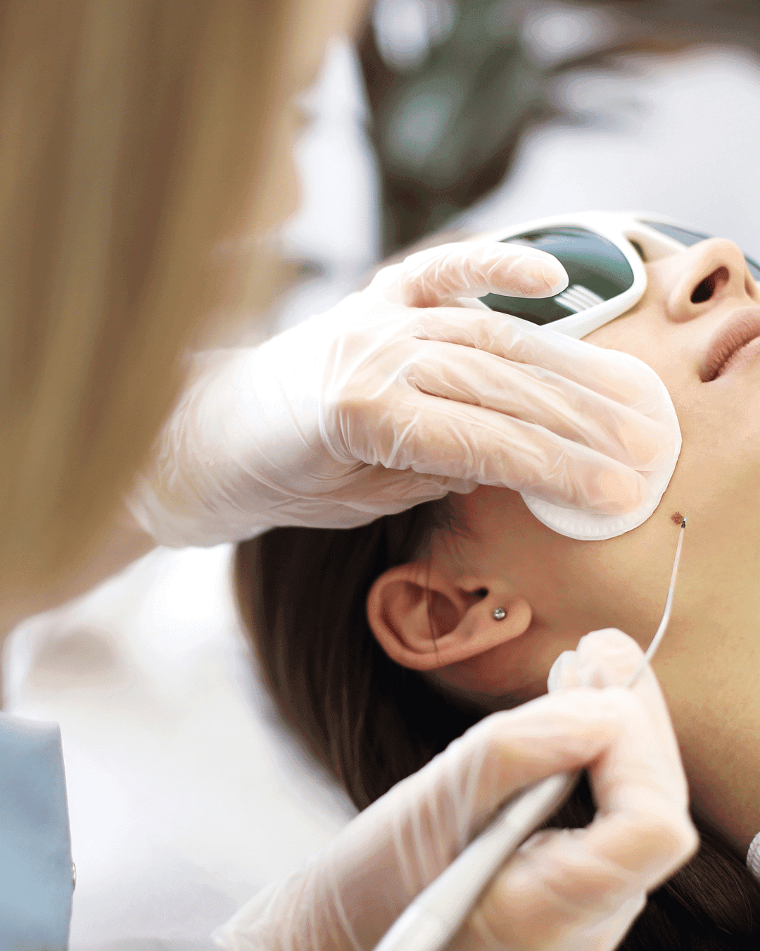 Dermal Protection