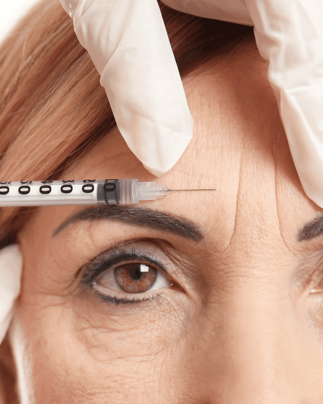 Dermal Myomodulation